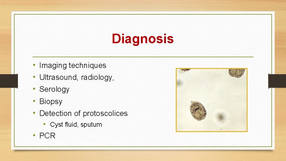 Diagnosis • • • Imaging techniques Ultrasound, radiology, Serology Biopsy Detection of protoscolices •