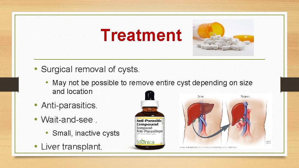 Treatment • Surgical removal of cysts. • May not be possible to remove entire