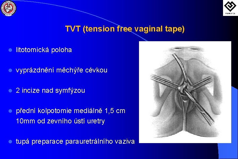 TVT (tension free vaginal tape) l litotomická poloha l vyprázdnění měchýře cévkou l 2