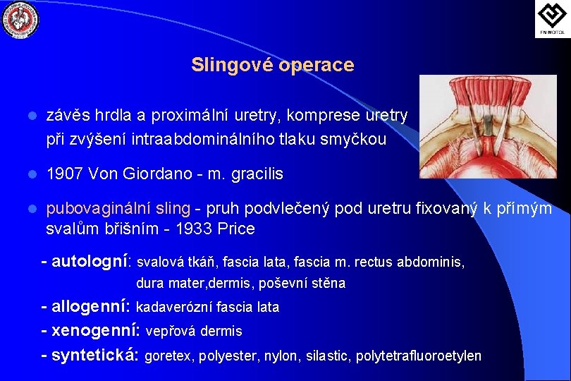 Slingové operace l závěs hrdla a proximální uretry, komprese uretry při zvýšení intraabdominálního tlaku