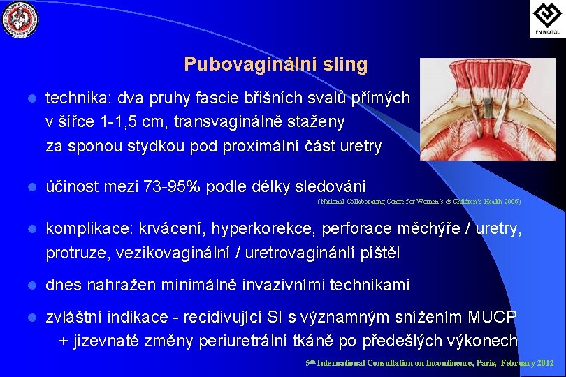 Pubovaginální sling l technika: dva pruhy fascie břišních svalů přímých v šířce 1 -1,