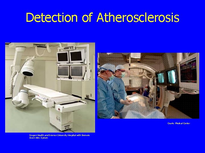 Detection of Atherosclerosis Ozarks Medical Center Oregon Health and Science University Hospital with Siemens