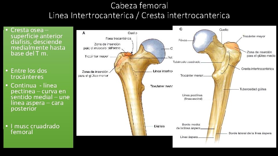 Cabeza femoral Linea Intertrocanterica / Cresta intertrocanterica • M Cresta osea – TCabeza –