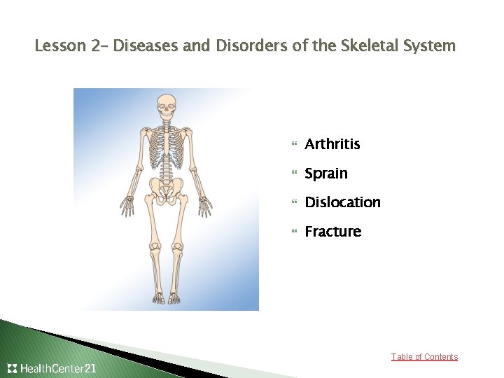 Lesson 2– Diseases and Disorders of the Skeletal System Arthritis Sprain Dislocation Fracture Table
