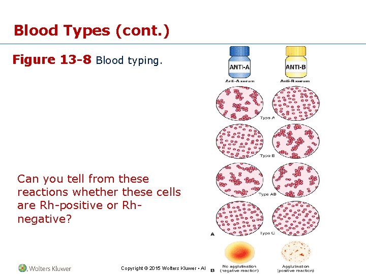 Blood Types (cont. ) Figure 13 -8 Blood typing. Can you tell from these