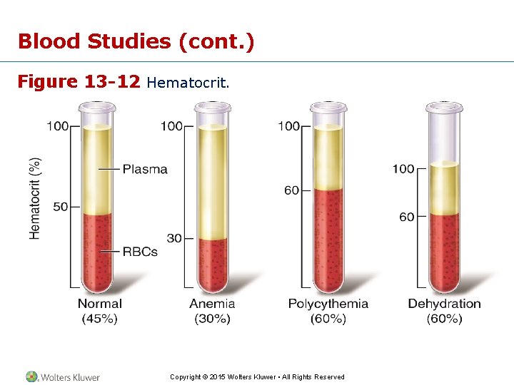 Blood Studies (cont. ) Figure 13 -12 Hematocrit. Copyright © 2015 Wolters Kluwer •