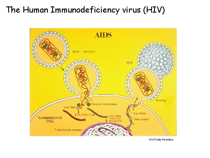 The Human Immunodeficiency virus (HIV) NCI/Trudy Nicholson. 