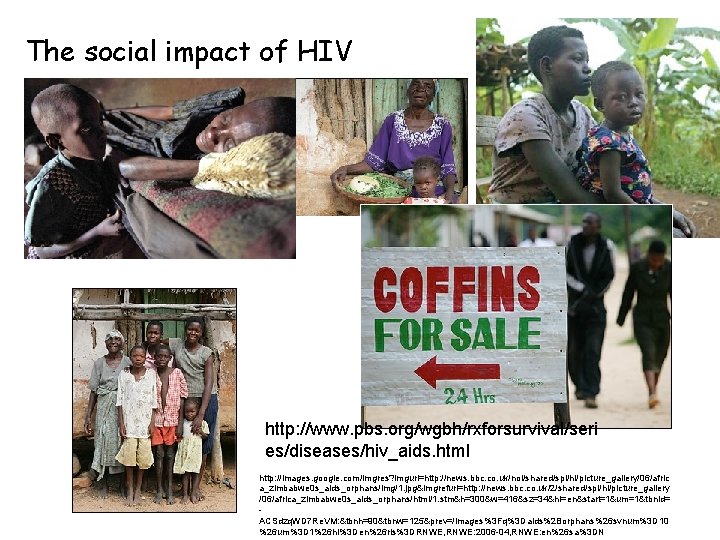 The social impact of HIV http: //www. pbs. org/wgbh/rxforsurvival/seri es/diseases/hiv_aids. html http: //images. google.