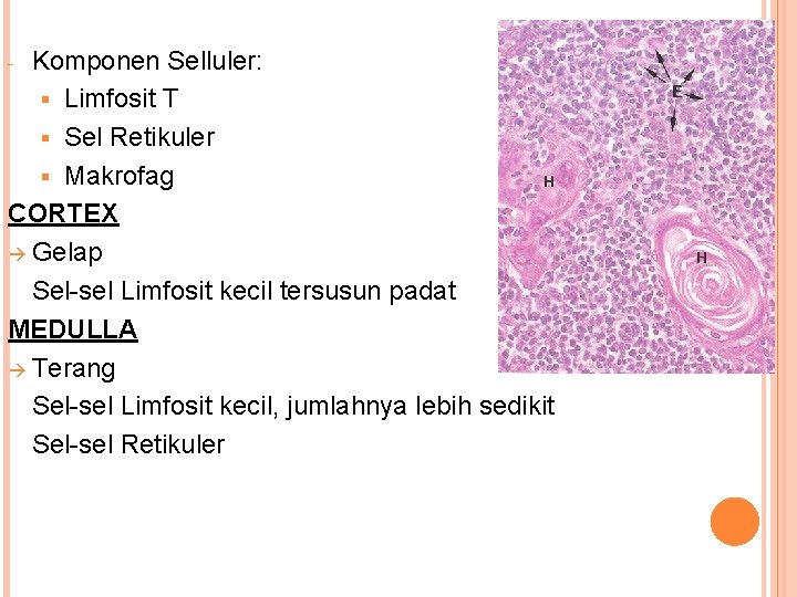 Komponen Selluler: § Limfosit T § Sel Retikuler § Makrofag CORTEX Gelap Sel-sel Limfosit