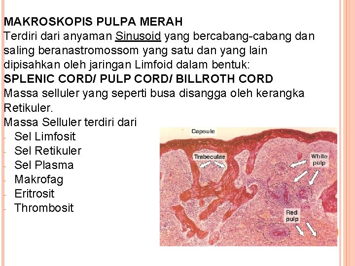 MAKROSKOPIS PULPA MERAH Terdiri dari anyaman Sinusoid yang bercabang-cabang dan saling beranastromossom yang satu