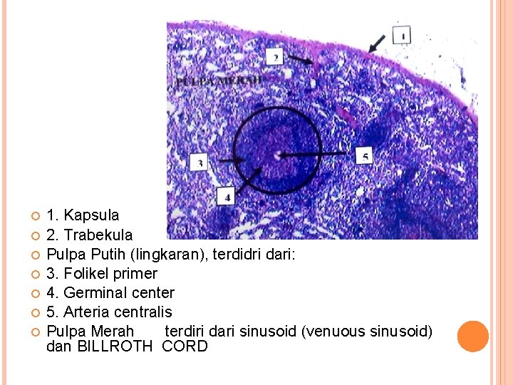  1. Kapsula 2. Trabekula Pulpa Putih (lingkaran), terdidri dari: 3. Folikel primer 4.