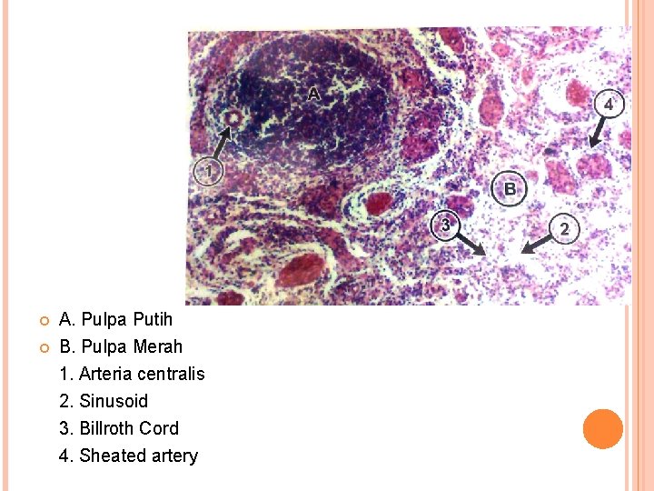  A. Pulpa Putih B. Pulpa Merah 1. Arteria centralis 2. Sinusoid 3. Billroth