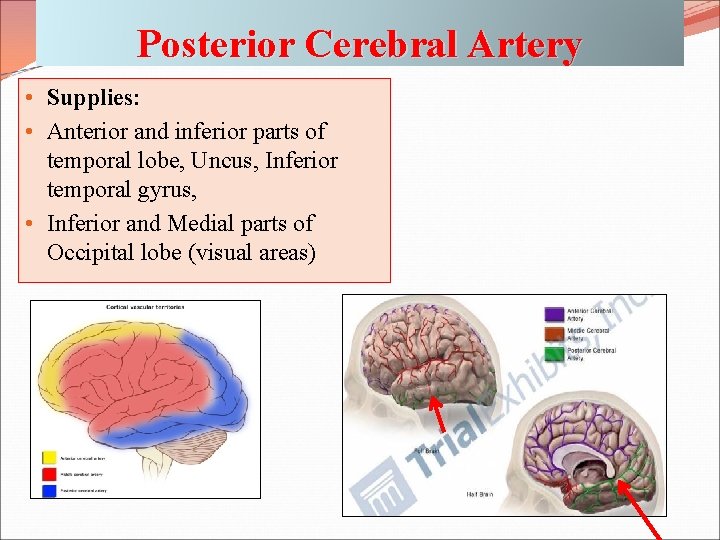 Posterior Cerebral Artery • Supplies: • Anterior and inferior parts of temporal lobe, Uncus,