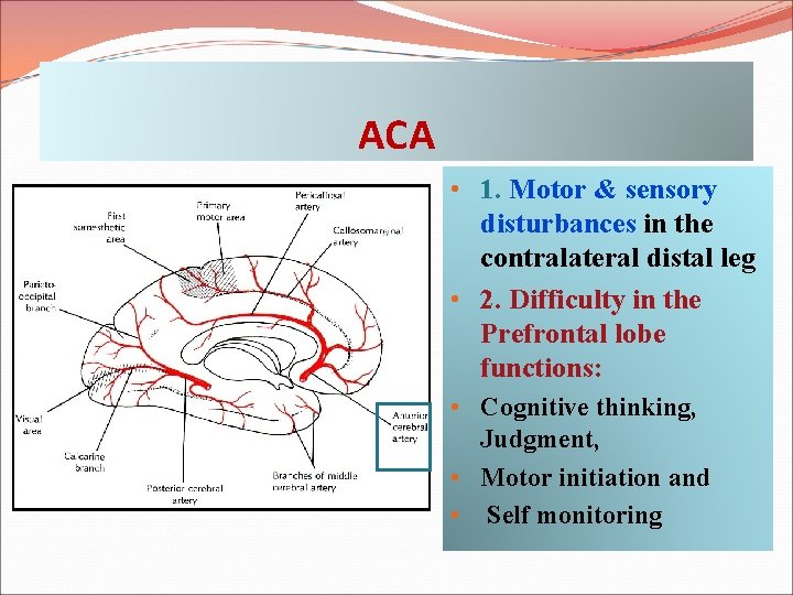 ACA • 1. Motor & sensory disturbances in the contralateral distal leg • 2.