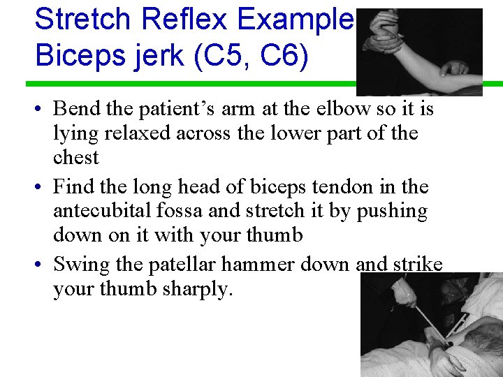 Stretch Reflex Example Biceps jerk (C 5, C 6) • Bend the patient’s arm