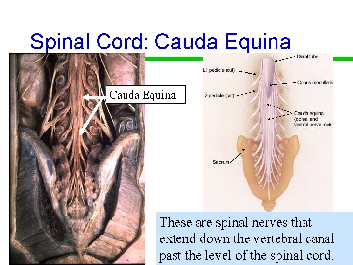 Spinal Cord: Cauda Equina These are spinal nerves that extend down the vertebral canal