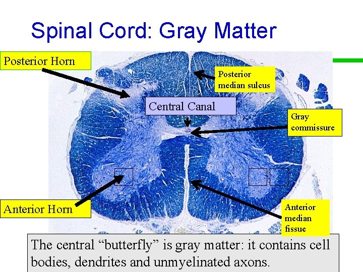 Spinal Cord: Gray Matter Posterior Horn Posterior median sulcus Central Canal Anterior Horn Gray