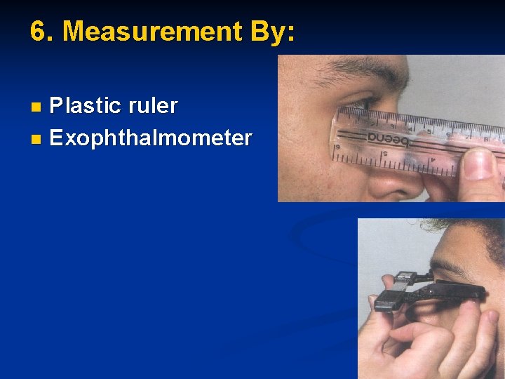 6. Measurement By: Plastic ruler n Exophthalmometer n 