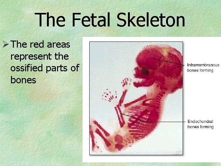 The Fetal Skeleton Ø The red areas represent the ossified parts of bones 