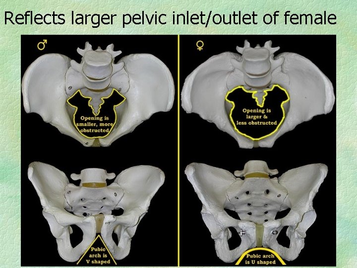 Reflects larger pelvic inlet/outlet of female 