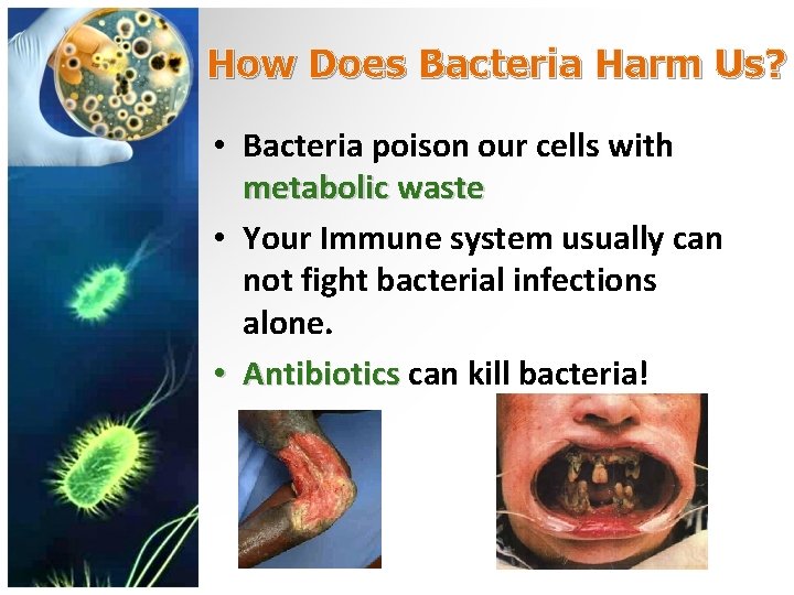 How Does Bacteria Harm Us? • Bacteria poison our cells with metabolic waste •