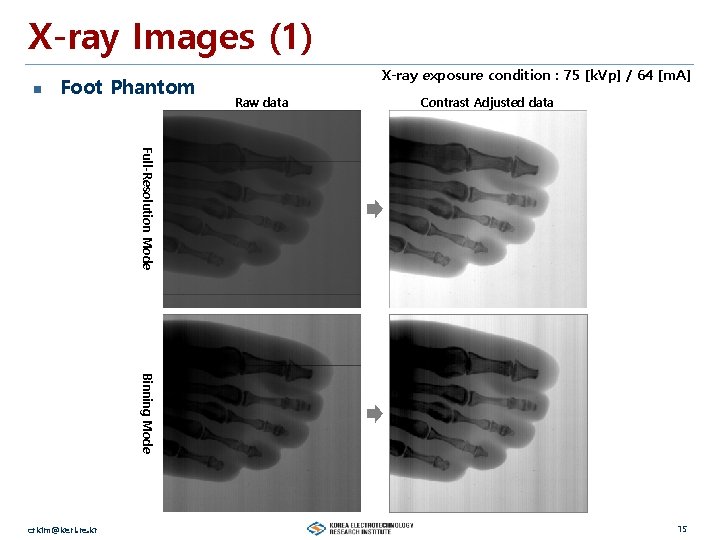 X-ray Images (1) n Foot Phantom X-ray exposure condition : 75 [k. Vp] /