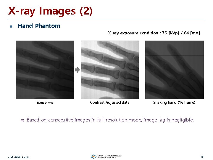 X-ray Images (2) n Hand Phantom X-ray exposure condition : 75 [k. Vp] /