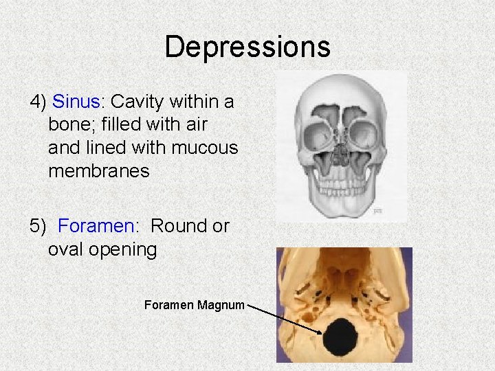 Depressions 4) Sinus: Cavity within a bone; filled with air and lined with mucous