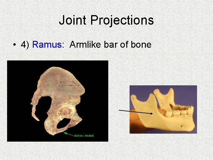 Joint Projections • 4) Ramus: Armlike bar of bone 