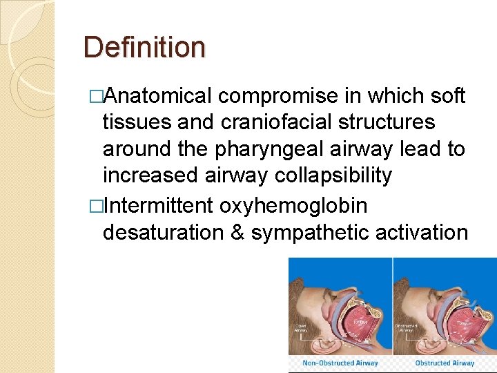Definition �Anatomical compromise in which soft tissues and craniofacial structures around the pharyngeal airway