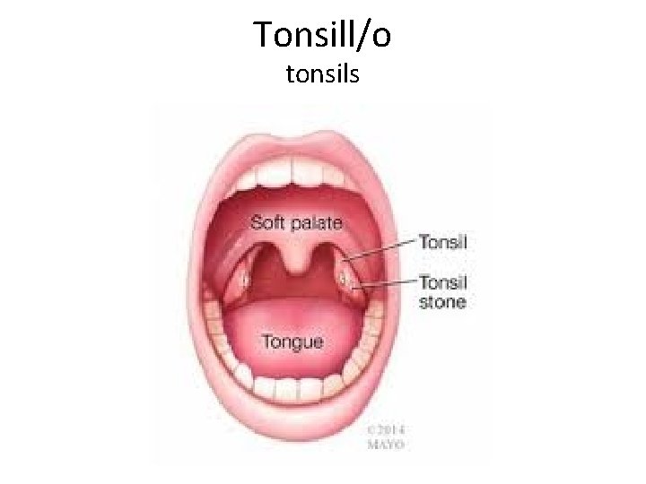 Tonsill/o tonsils 