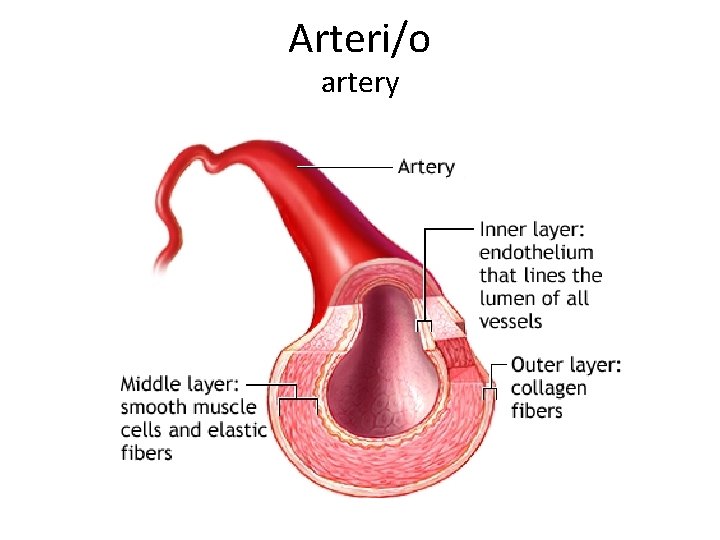 Arteri/o artery 