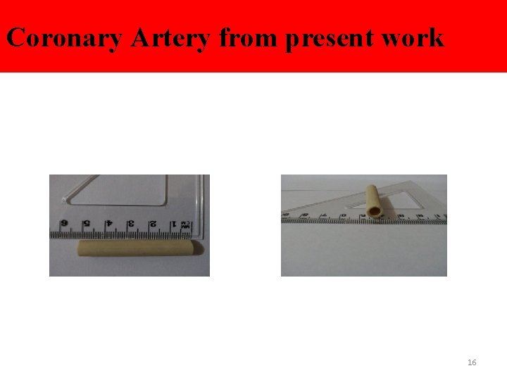 Coronary Artery from present work 16 