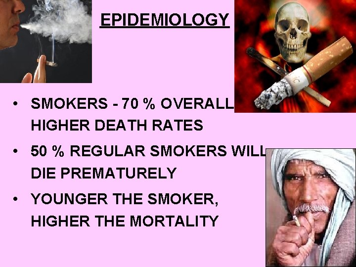 EPIDEMIOLOGY • SMOKERS - 70 % OVERALL HIGHER DEATH RATES • 50 % REGULAR