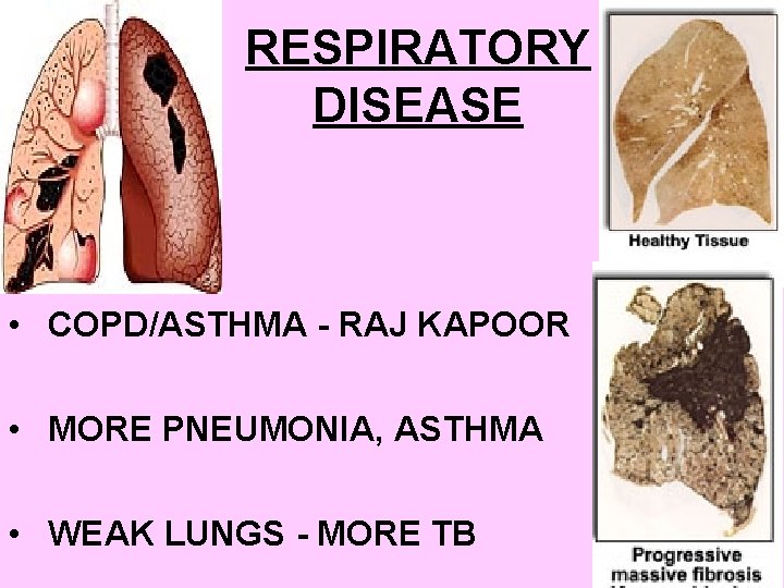 RESPIRATORY DISEASE • COPD/ASTHMA - RAJ KAPOOR • MORE PNEUMONIA, ASTHMA • WEAK LUNGS