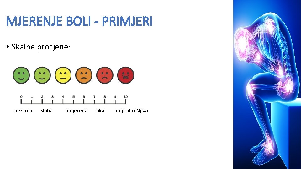 MJERENJE BOLI - PRIMJERI • Skalne procjene: bez boli slaba umjerena jaka nepodnošljiva 