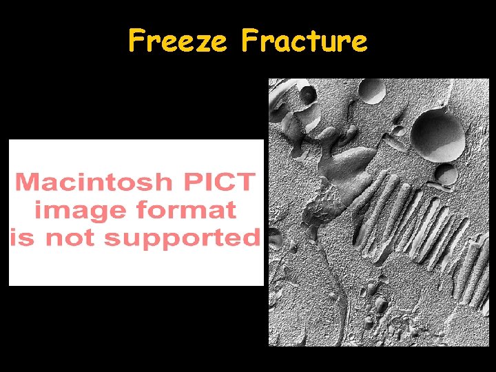 Freeze Fracture 