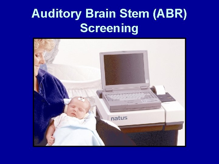 Auditory Brain Stem (ABR) Screening 