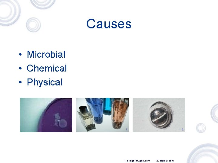 Causes • Microbial • Chemical • Physical 1 1. budgetimages. com 2 2. bigfoto.