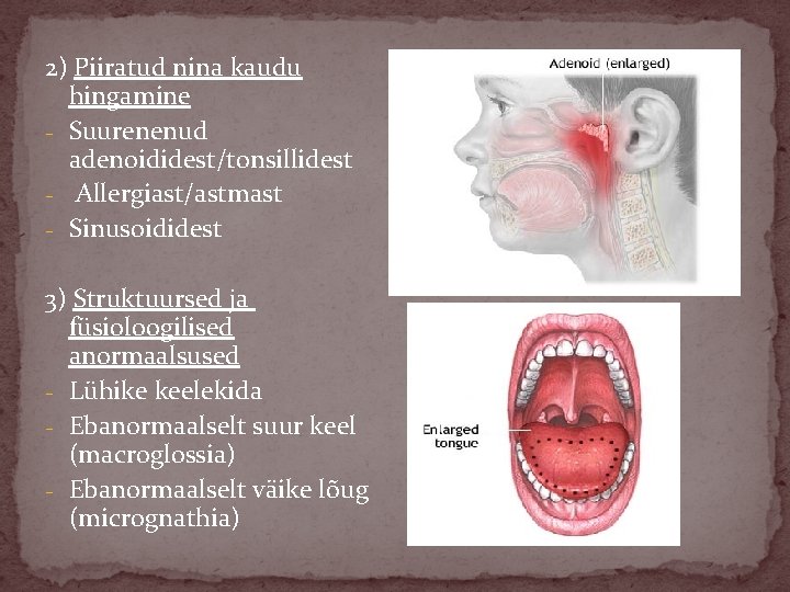 2) Piiratud nina kaudu hingamine - Suurenenud adenoididest/tonsillidest - Allergiast/astmast - Sinusoididest 3) Struktuursed