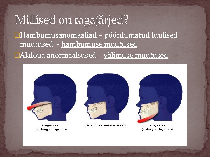 Millised on tagajärjed? �Hambumusanomaaliad – pöördumatud luulised muutused - hambumuse muutused �Alalõua anormaalsused –