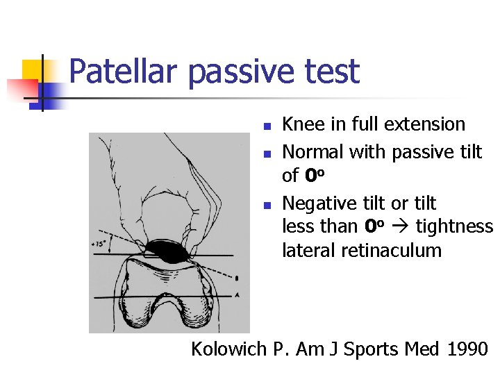 Patellar passive test n n n Knee in full extension Normal with passive tilt