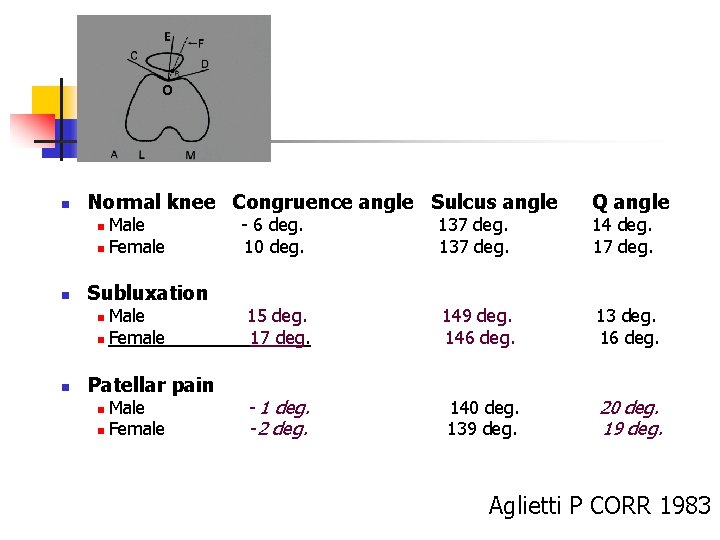 o n Normal knee Congruence angle Sulcus angle Male n Female n n Subluxation