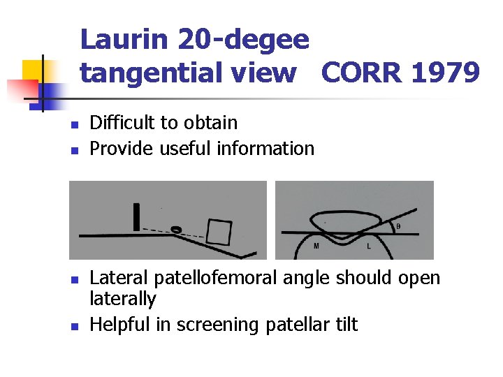 Laurin 20 -degee tangential view CORR 1979 n n Difficult to obtain Provide useful