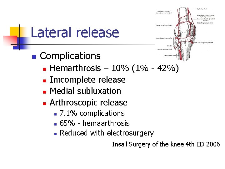 Lateral release n Complications n n Hemarthrosis – 10% (1% - 42%) Imcomplete release