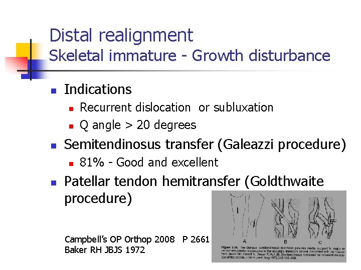 Distal realignment Skeletal immature - Growth disturbance n Indications n n n Semitendinosus transfer