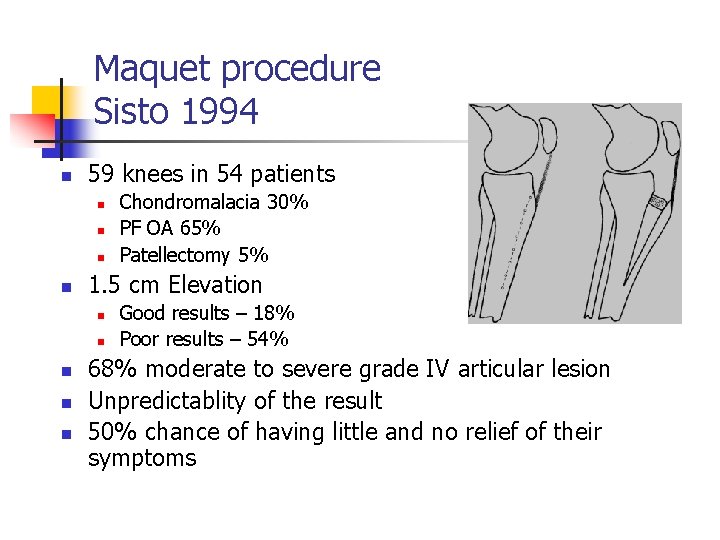 Maquet procedure Sisto 1994 n 59 knees in 54 patients n n 1. 5