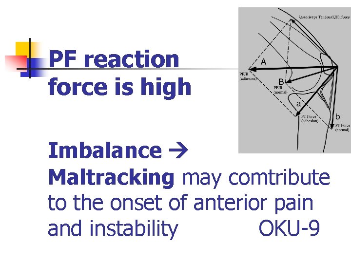 PF reaction force is high Imbalance Maltracking may comtribute to the onset of anterior