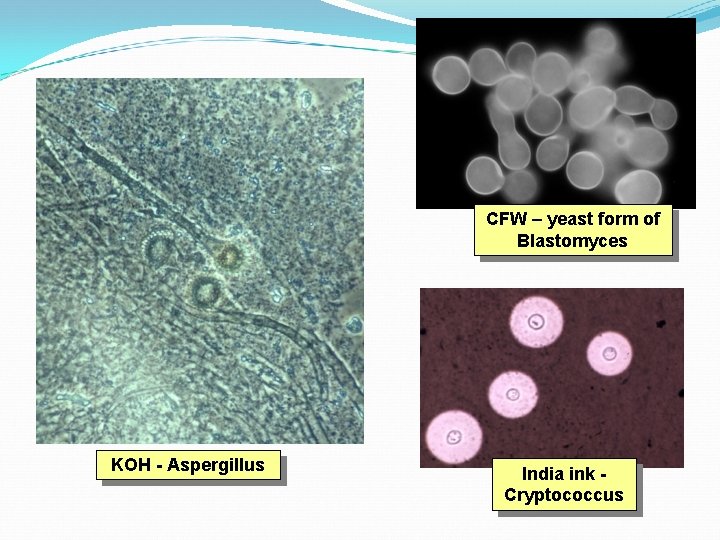 CFW – yeast form of Blastomyces KOH - Aspergillus India ink Cryptococcus 