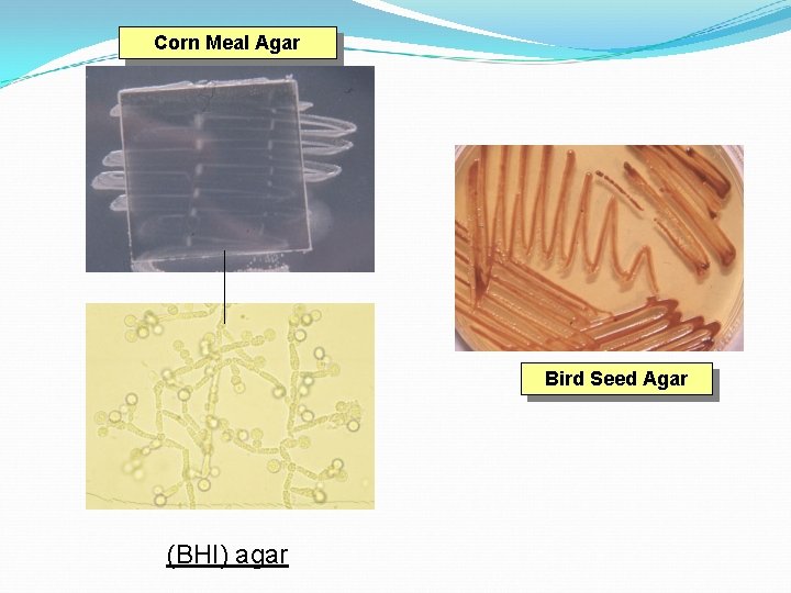 Corn Meal Agar Bird Seed Agar (BHI) agar 